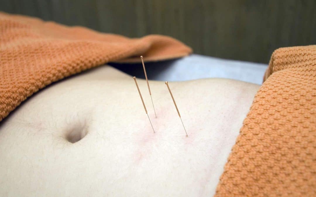 How Does Acupuncture Work?